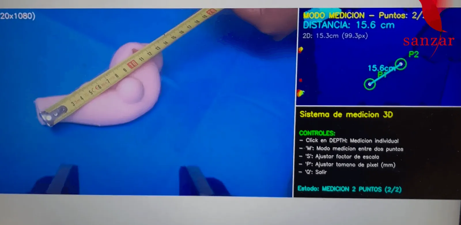 3D measurement from the laparoscopic camera